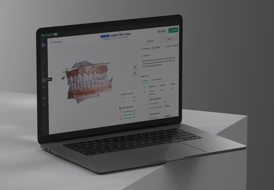 UI/UX Design